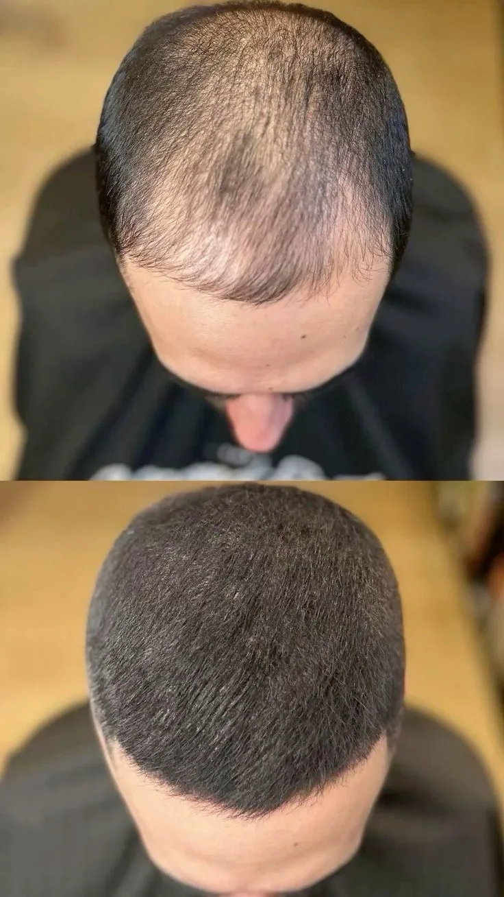 Saç Similasyon - Hair Simulation